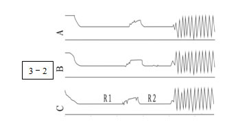 ׃�������d�_(k��i)�P(gu��n)�y(c��)ԇ�x��Ҋ(ji��n)���η�����